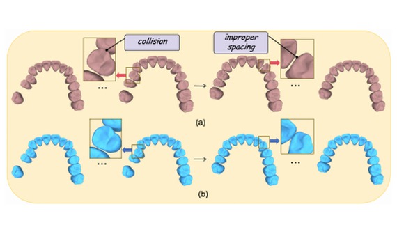 Efficient ToothAR pipeline